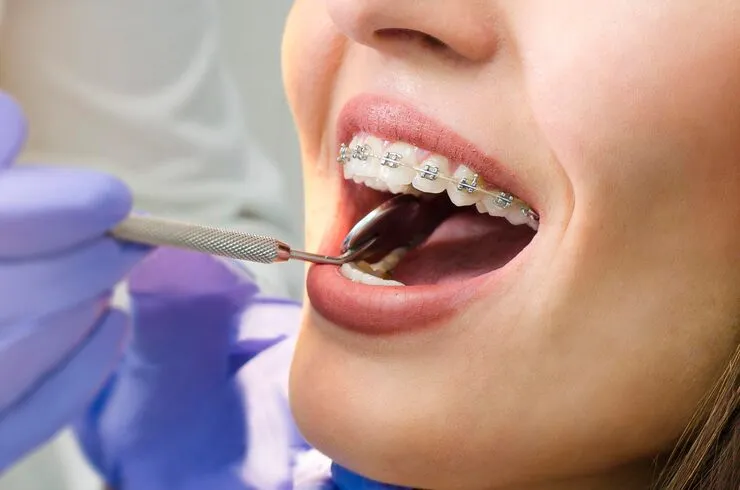 Choosing the Best Orthodontist in NYC: Expert Advice
