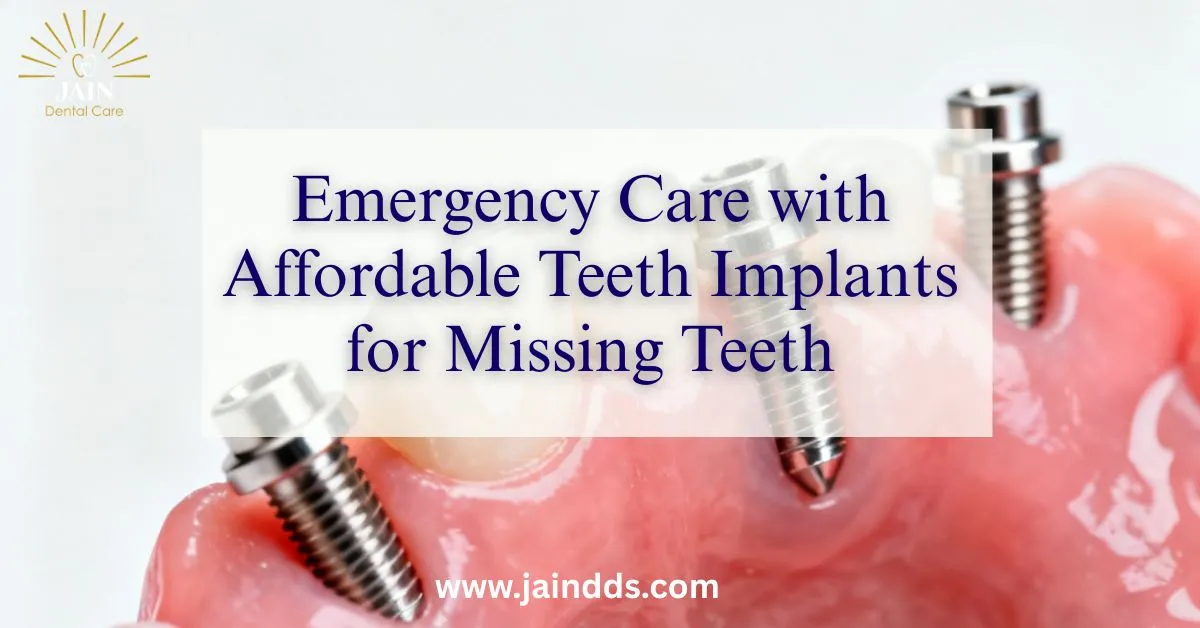 Emergency Care with Affordable Teeth Implants for Missing Teeth