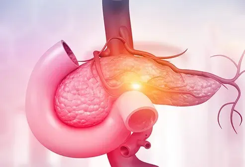 How Pancreatic Cancer Affects Your Digestive System and What to Know