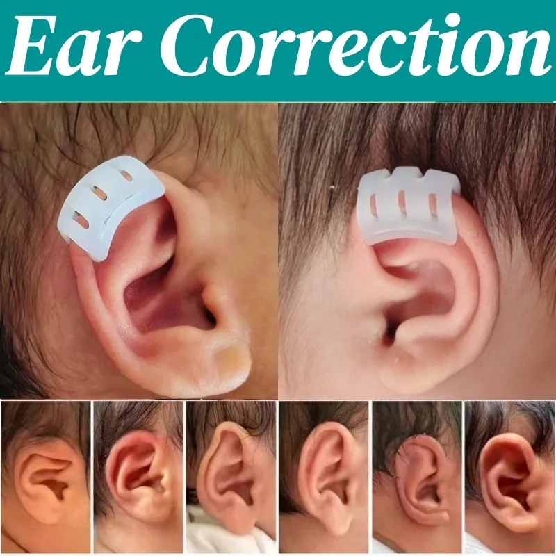 Baby Ear Corrector: Complete Nonsurgical Correction for Cryptotia Ear