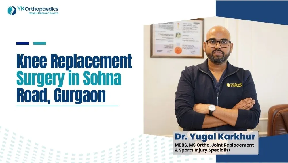 Knee Replacement Surgery in Sohna Road, Gurgaon