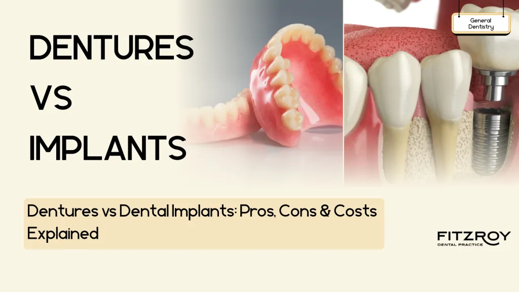 Dentures vs Dental Implants: What Are the Pros and Cons for Missing Teeth?