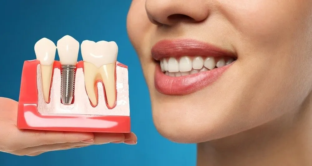 Bring Back Your Natural Smile with Dental Implant Treatment in Gota Ahmedabad