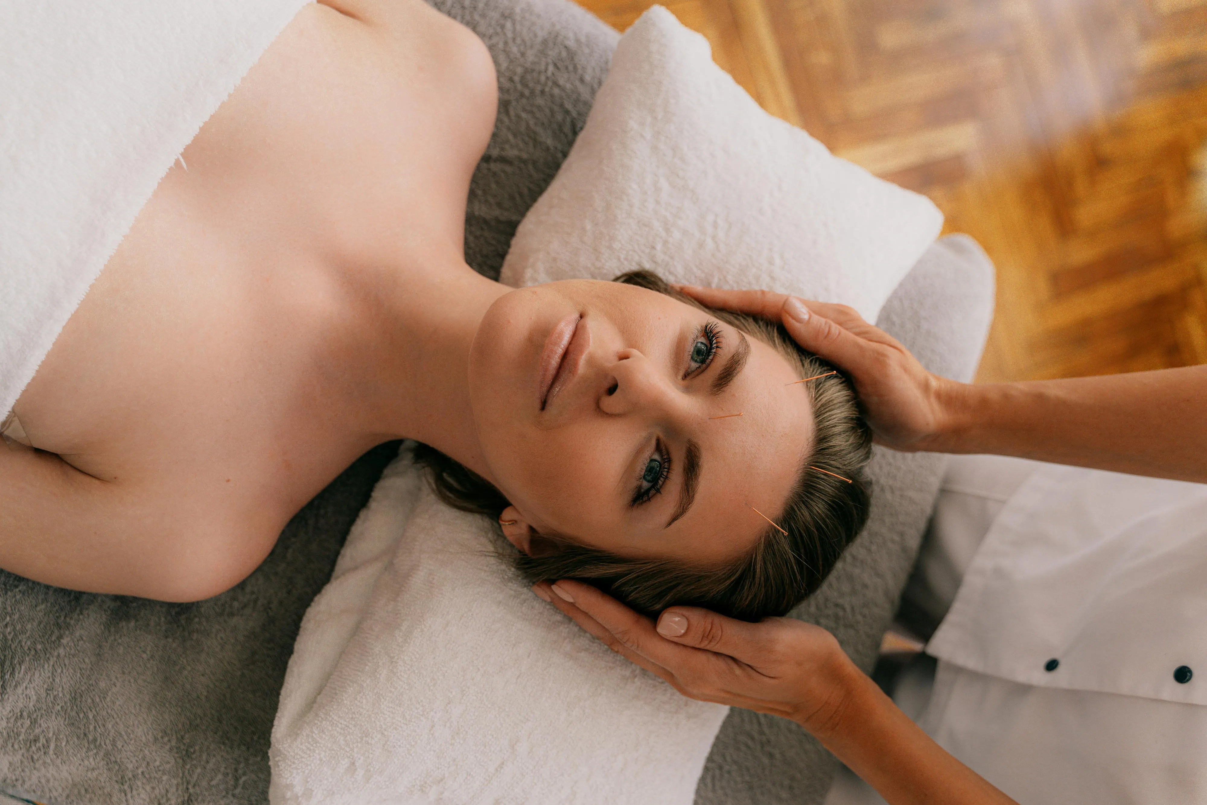 Common Mistakes to Avoid Before Trying Cosmetic Acupuncture in San Francisco