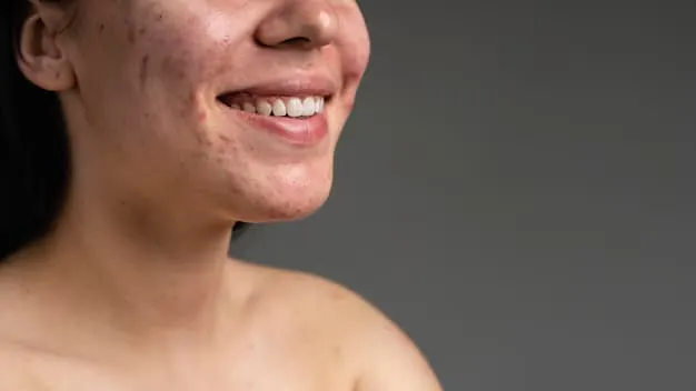 How to Treat Hyperpigmentation in Birmingham’s Climate