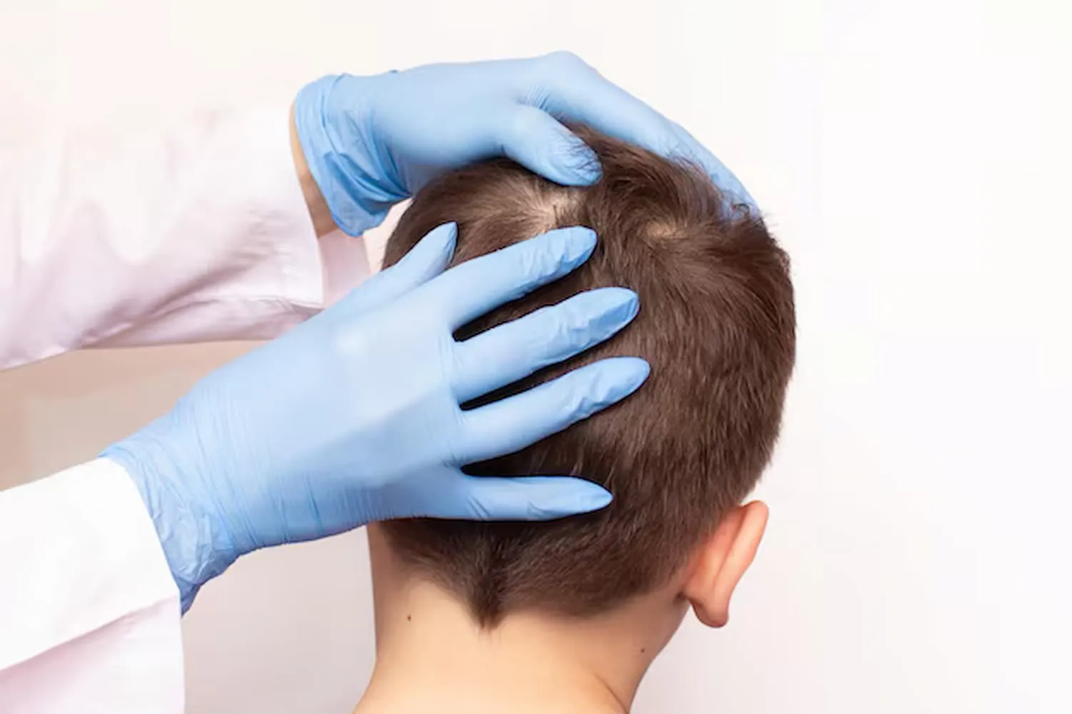 Best Treatments at Hair Loss Clinics in Leeds