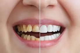 Who Is the Top-Rated Orthodontist in Johnsonville WI?