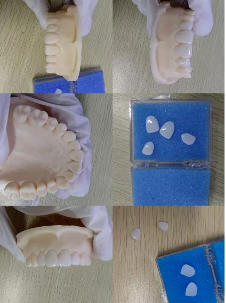 Why Choose Cosmetic Dentistry Solutions China for Smile Makeovers?