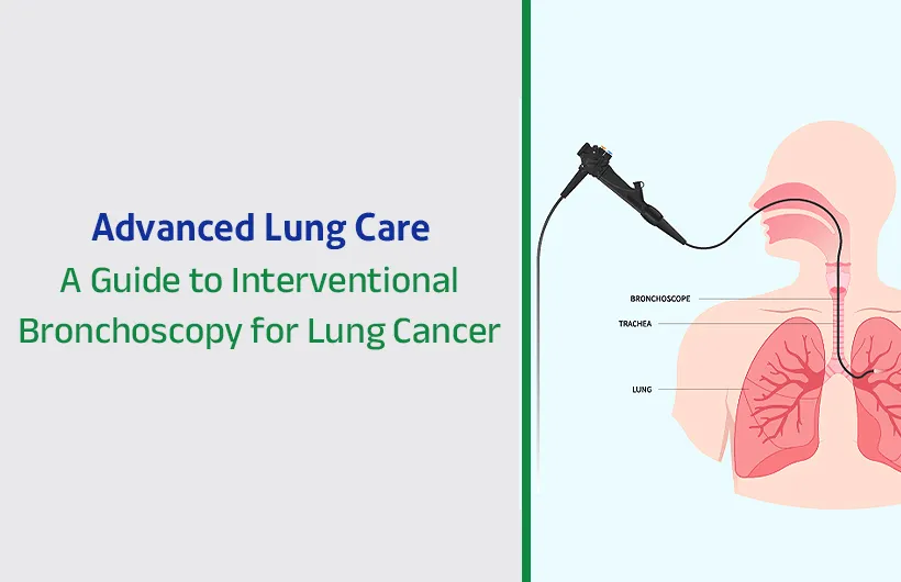 What is a Spirometry Test? Purpose, Procedure
