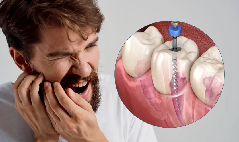 Root Canal Treatment: Symptoms, Procedure, and Aftercare Tips