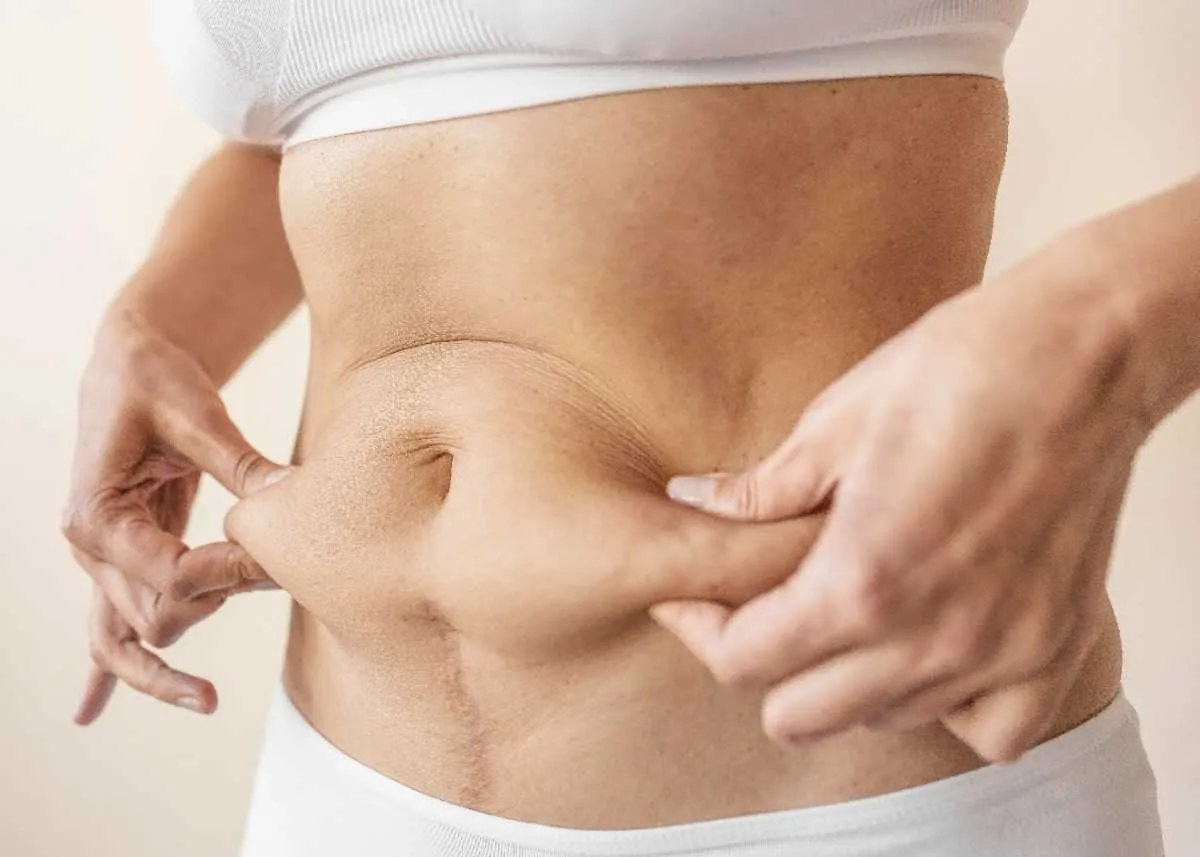 How Surgeon Experience Impacts Tummy Tuck Cost Cape Town