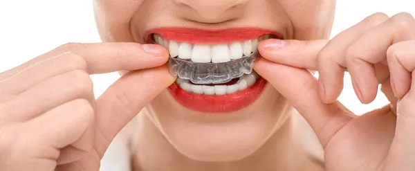 Comfort Meets Aesthetics: The Rise of Invisalign Treatment