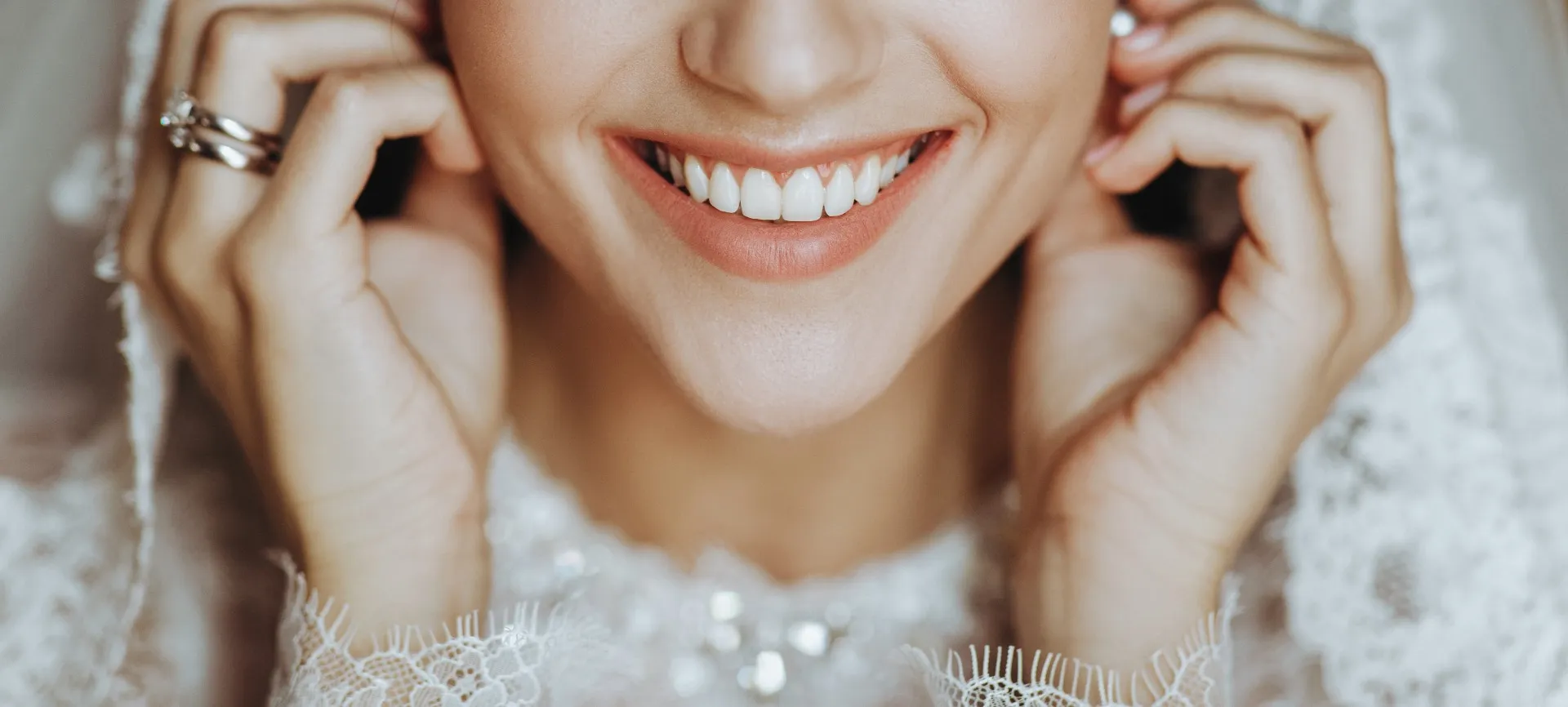 Planning Your Perfect Bridal Smile Makeover in Mumbai