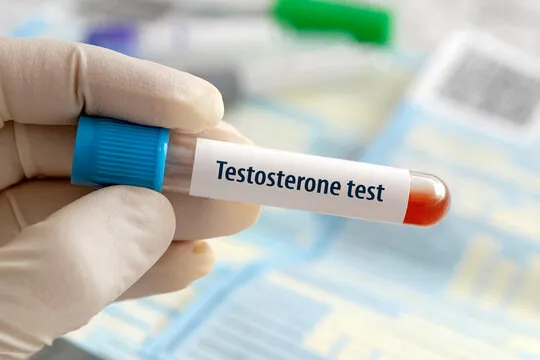 Testosterone Blood Test UK: Everything You Need to Know