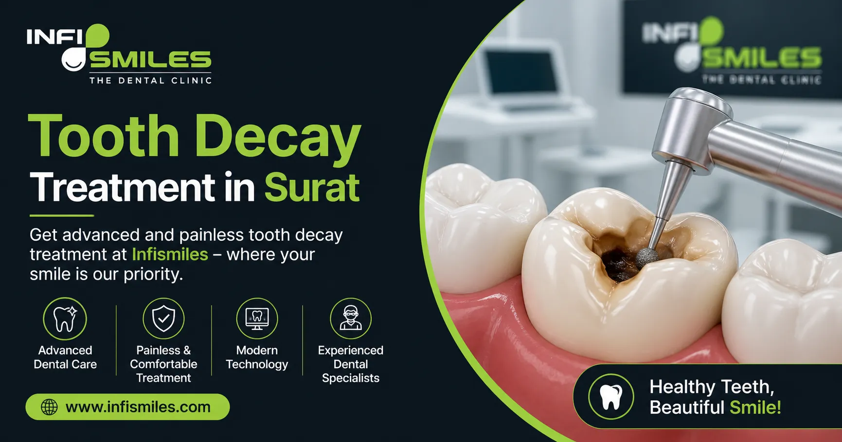 Top 7 Benefits of Tooth Decay Treatment in Surat Explained