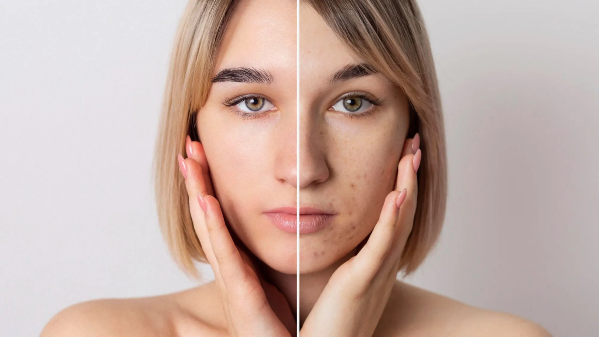 CoolSculpting in Delhi: Non-Surgical Body Contouring with Trusted Expert Care