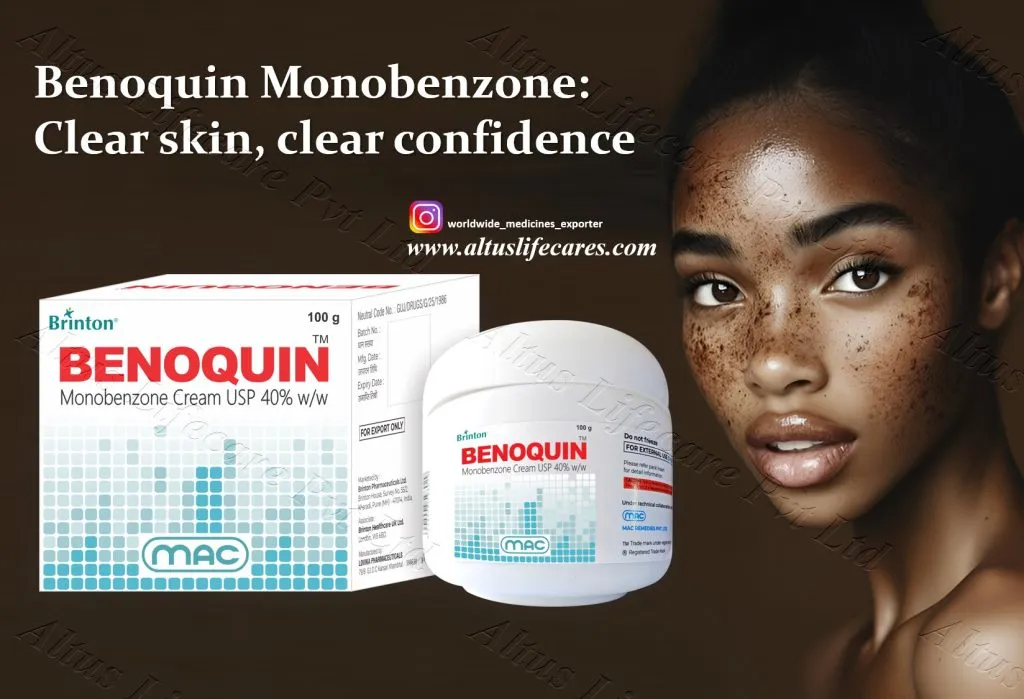 Uniqueen 40 Cream Monobenzone for Vitiligo Treatment