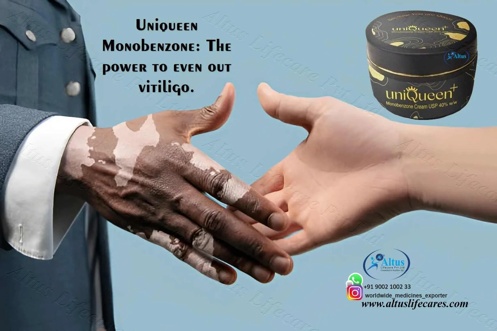Uniqueen 40 Cream: Powerful Help for Severe Vitiligo Skin