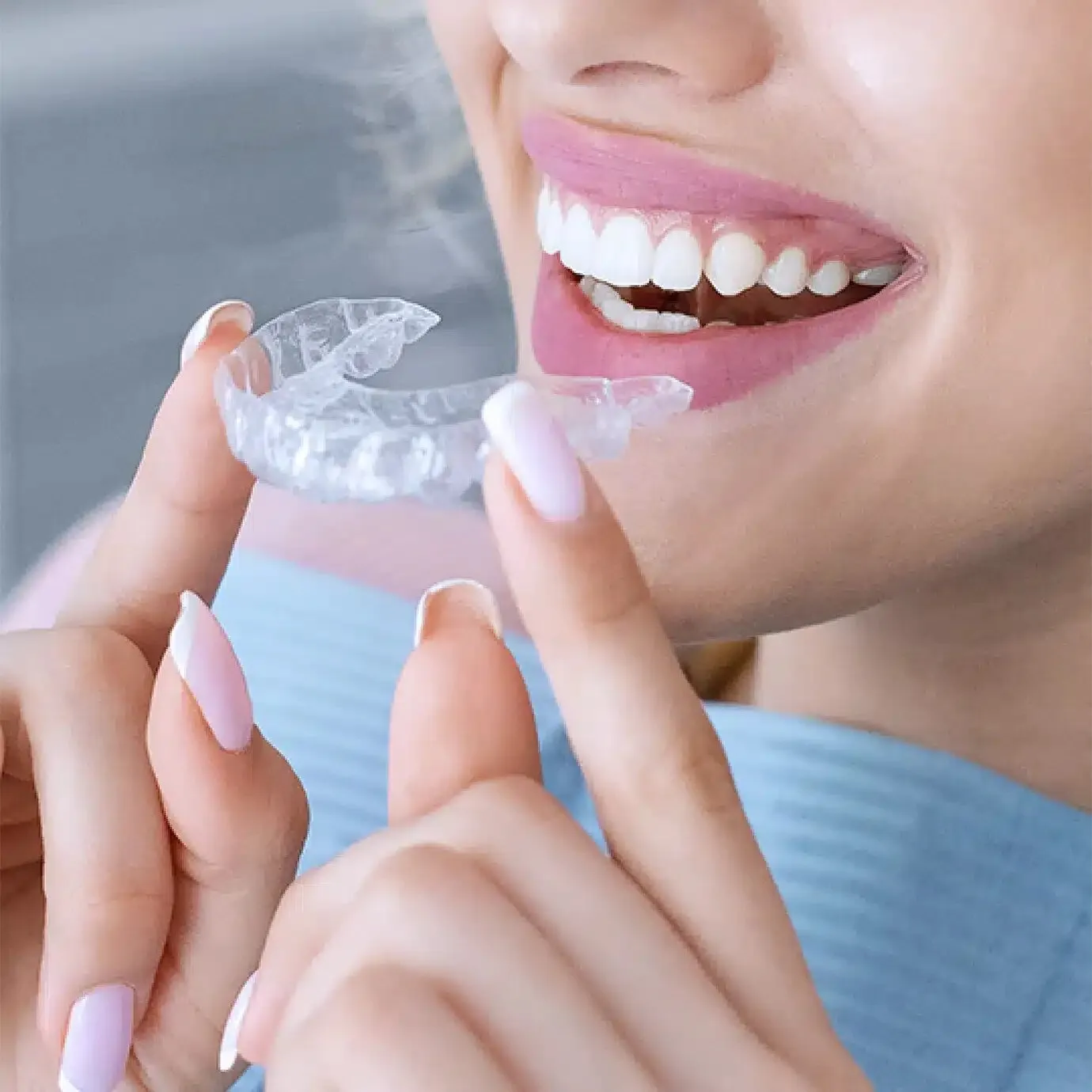 How Invisalign Aligners Work to Straighten Teeth in London