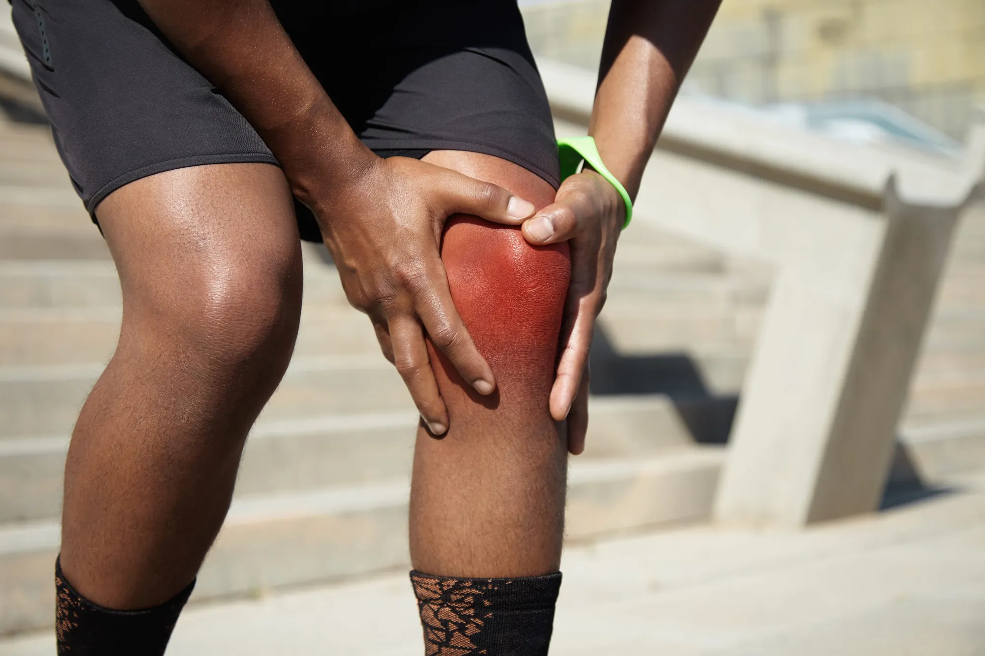 5 Common Sports Injuries: Reclaiming Your Performance Safely