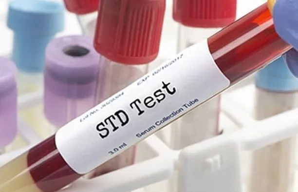 Reliable & Confidential STD Testing in Dubai for Your Health and Peace of Mind