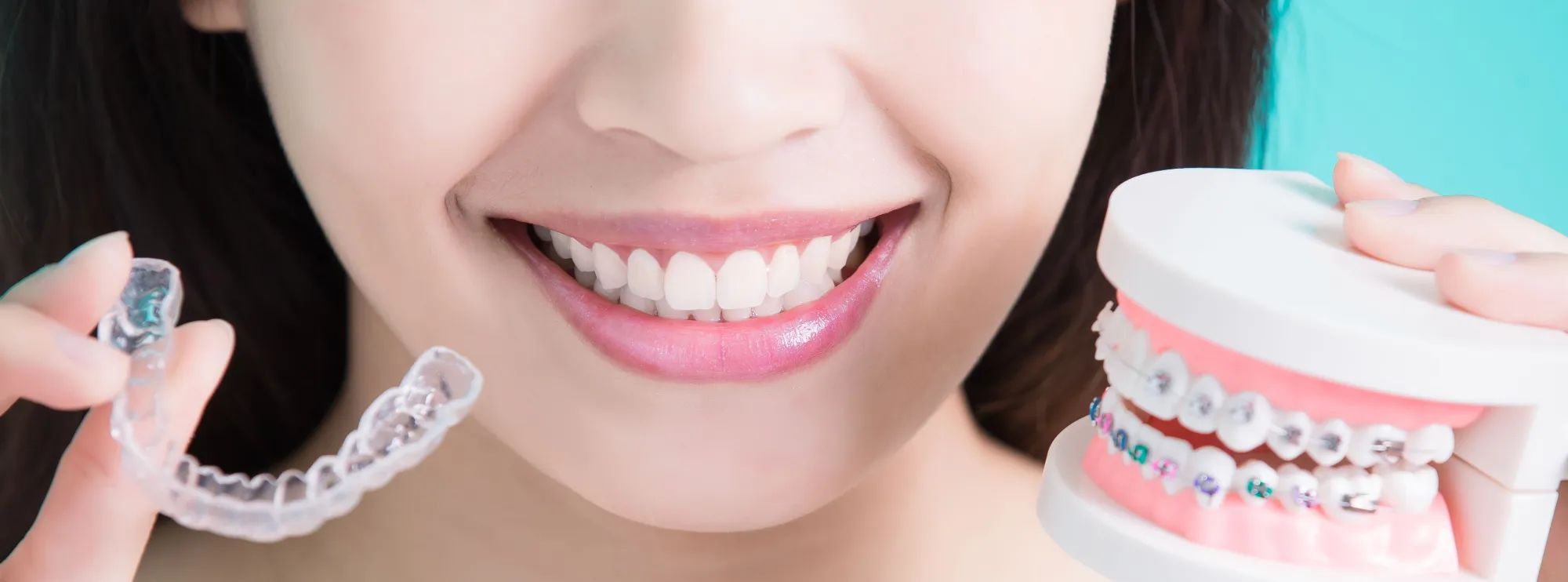 Want Straighter Teeth Without Braces? Try Clear Aligners in Kuvempu Nagara