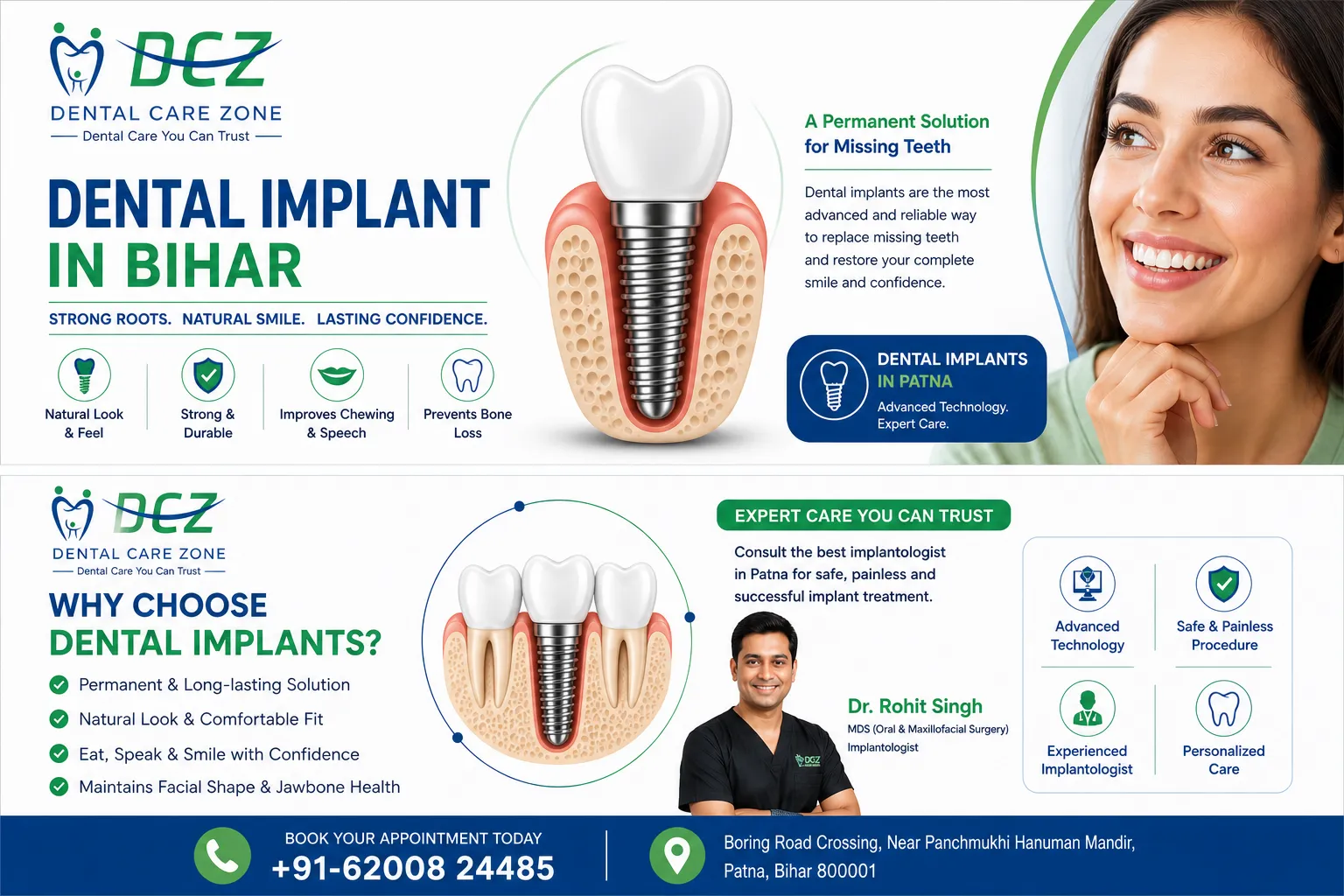 Complete Guide to Dental Implant in Patna by Dr. Rohit Singh