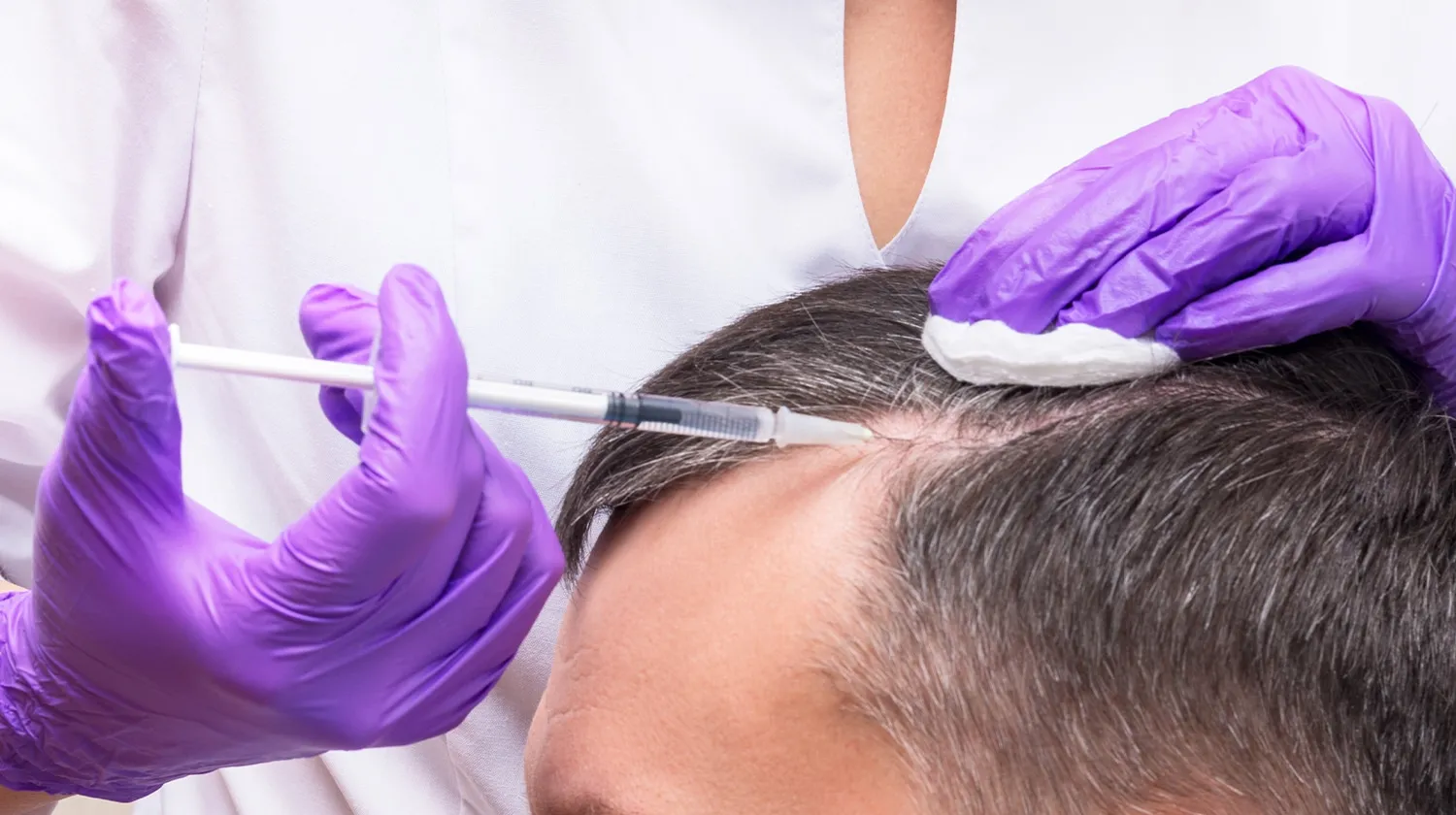 PRP Therapy for Hair Loss: Complete Guide to Cost, Benefits, and Hair Growth Results