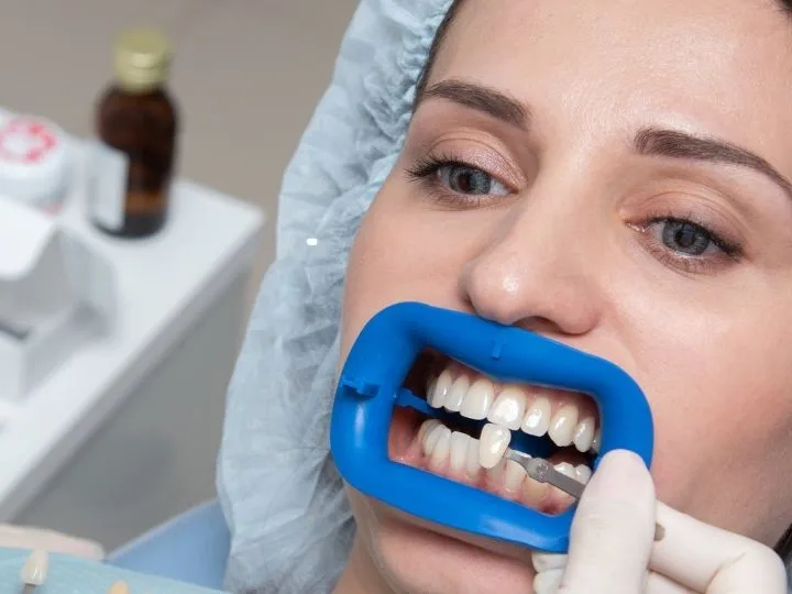 Dental Clinic for Implants, Braces & Whitening: What to Expect