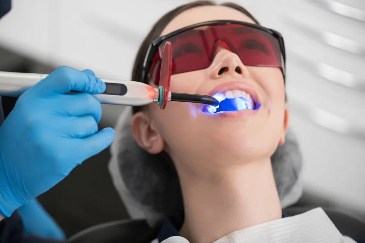 Why Does Teeth Whitening Cost Vary So Much? What You Should Know