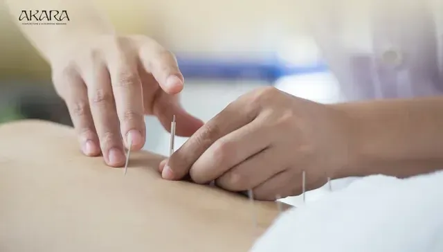 Top 5 Acupuncturists in San Francisco for 2026
