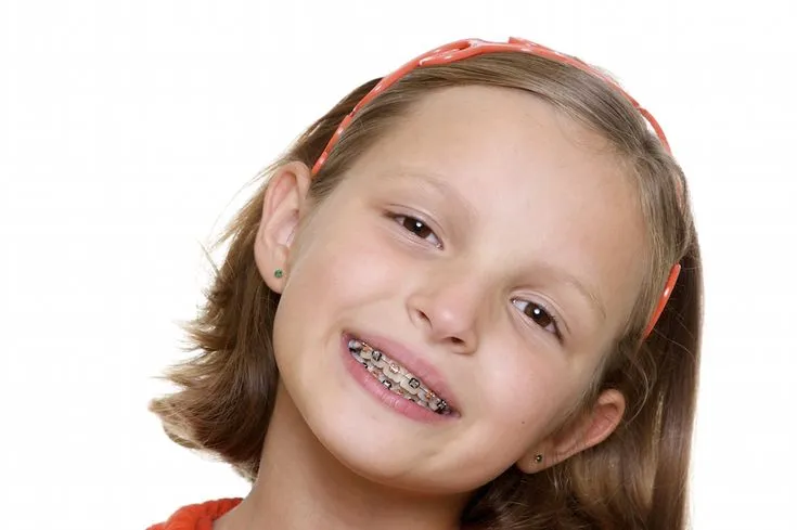 Pediatric Braces Treatment When Should Your Child Start
