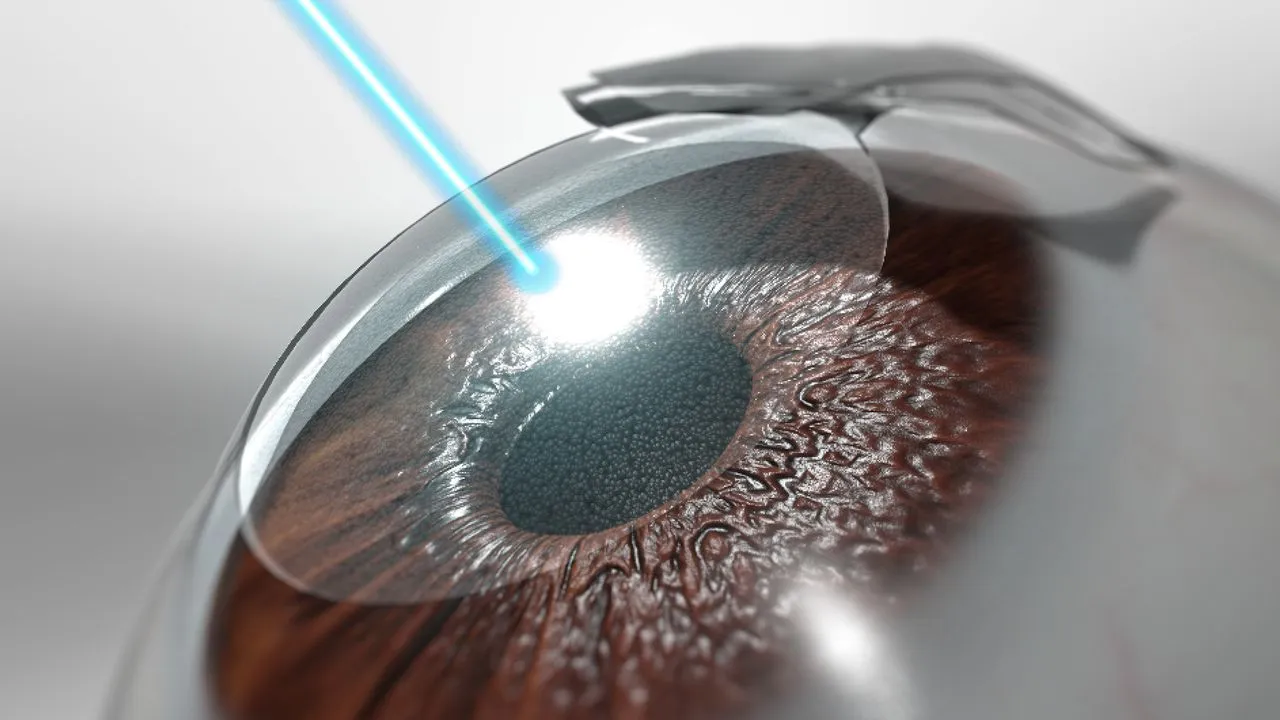 Get Familiar With Major Types Of Cataracts And Some Basic Preventive Measures