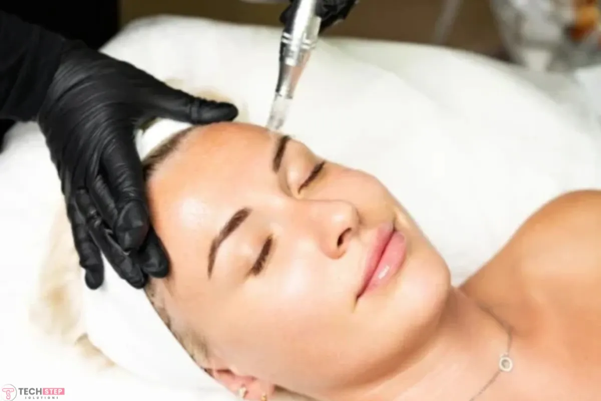 Microneedling Houston TX – A Modern Solution for Skin Rejuvenation