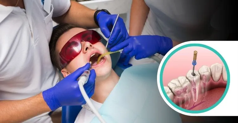 Why Delaying Root Canal Treatment Can Permanently Damage Your Smile