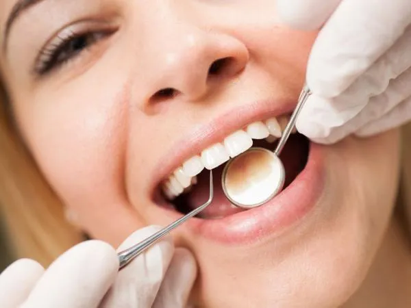Protect Your Smile with Regular Teeth Cleaning Near Me Appointments