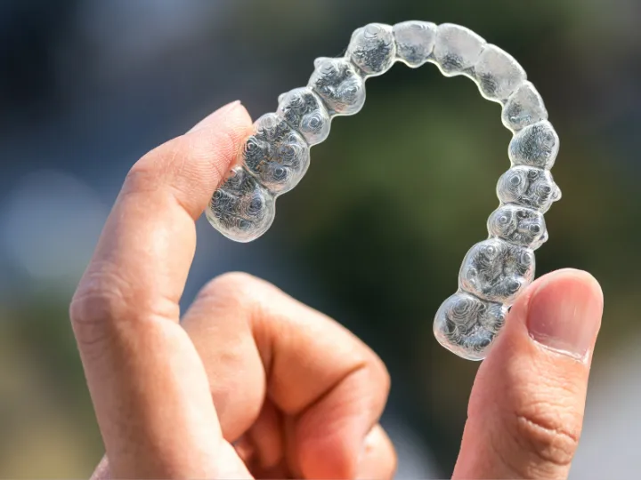 Retainers Cost Guide After Clear Aligners
