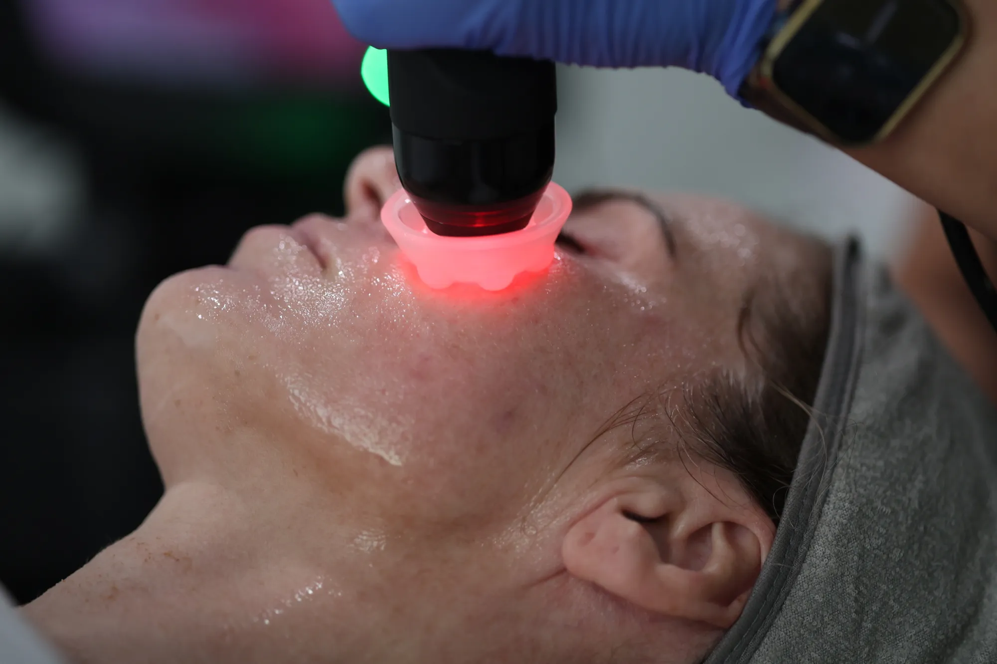 What Is a Triple MCH Facial? Everything You Should Know Before Booking