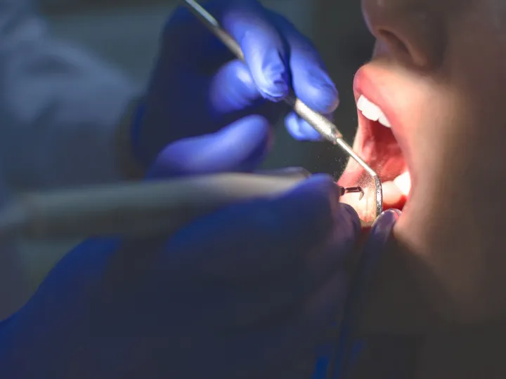 Emergency Dental Care Tips for Sudden Pain Guide