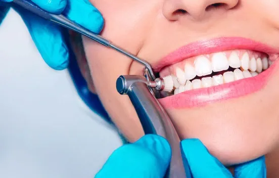Teeth Cleaning Benefits: Why Regular Dental Cleanings Are Essential