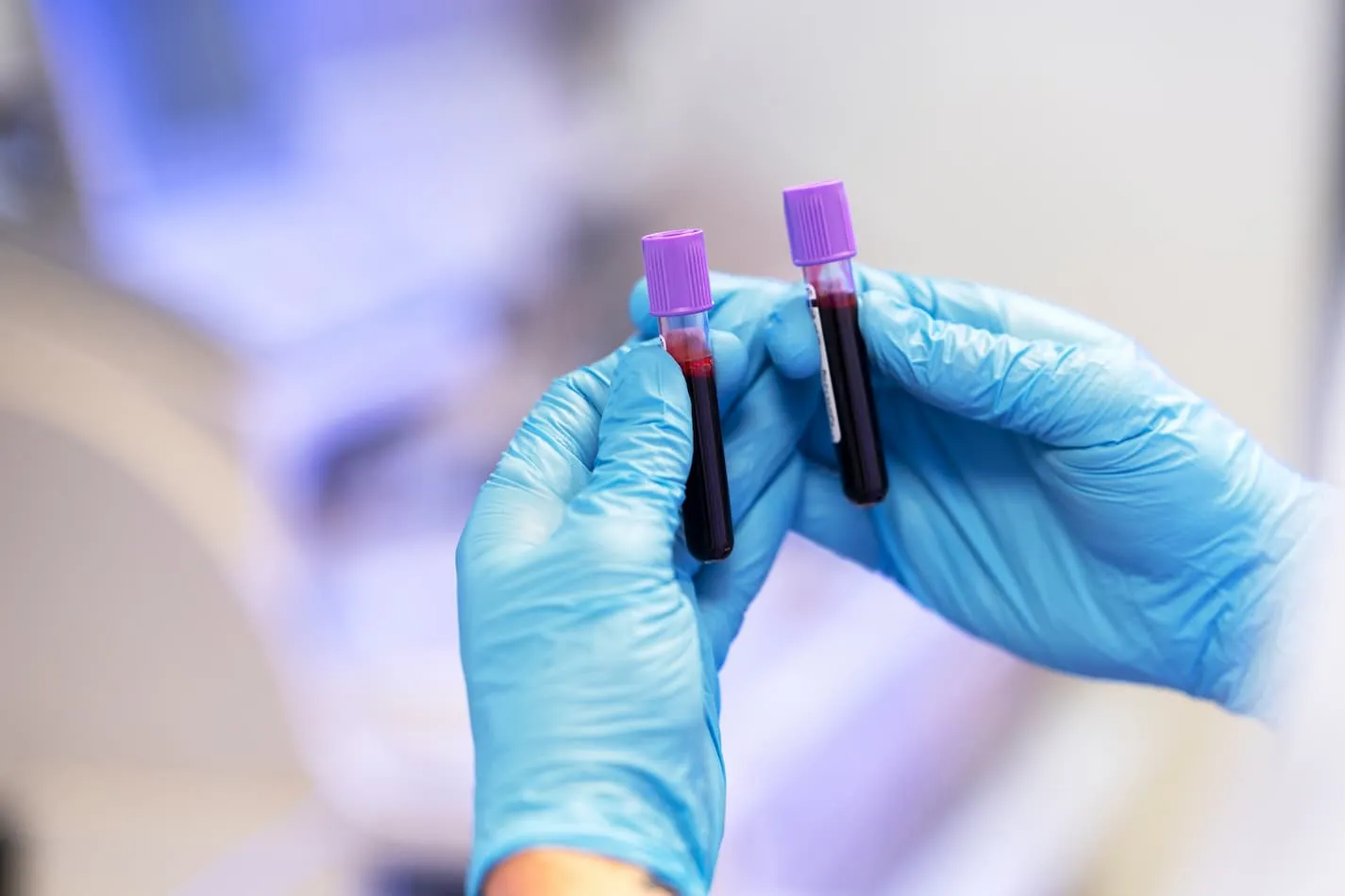 Blood Tests for Weight Loss UK: A Smarter Way to Understand Your Health