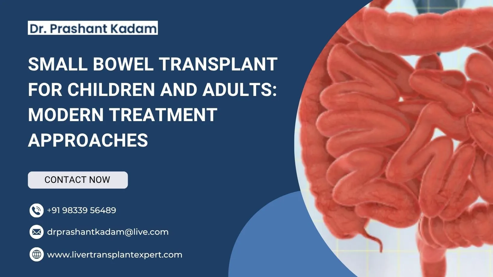 Small Bowel Transplant for Children and Adults: Modern Treatment Approaches