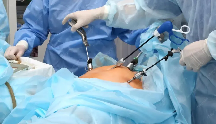How Long Does Recovery Take After Laparoscopic Surgery?