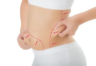 Fat Melting injection in Dubai