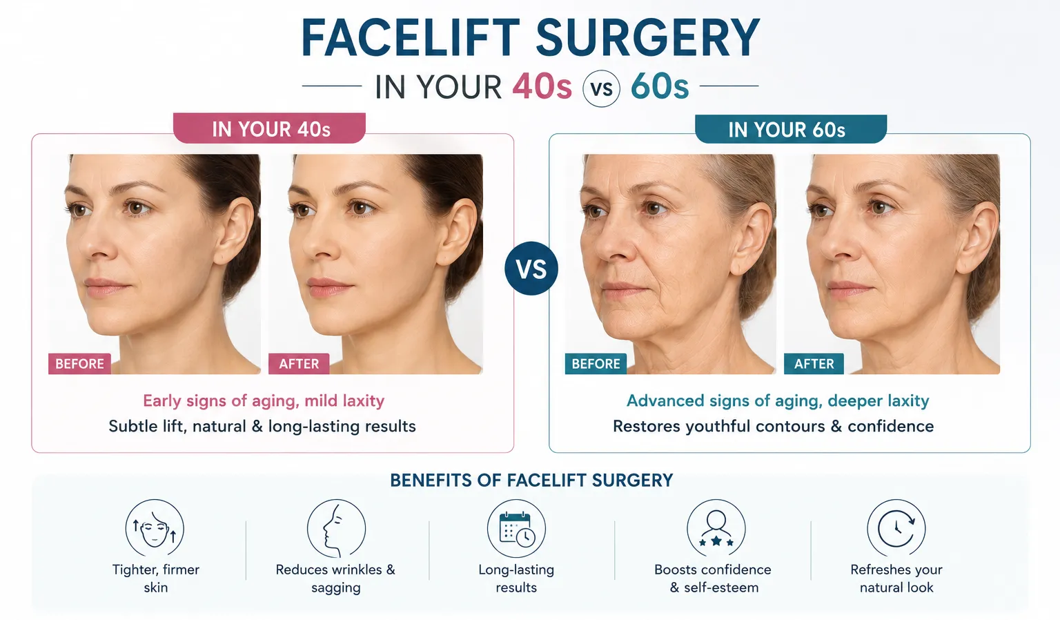 Facelift Surgery in Your 40s vs 60s Explained