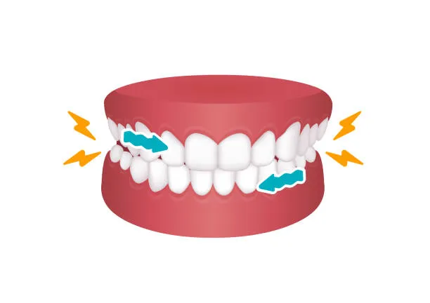 Full Mouth Rehabilitation in Mumbai: A Complete Smile Transformation Near Wadala & Dadar
