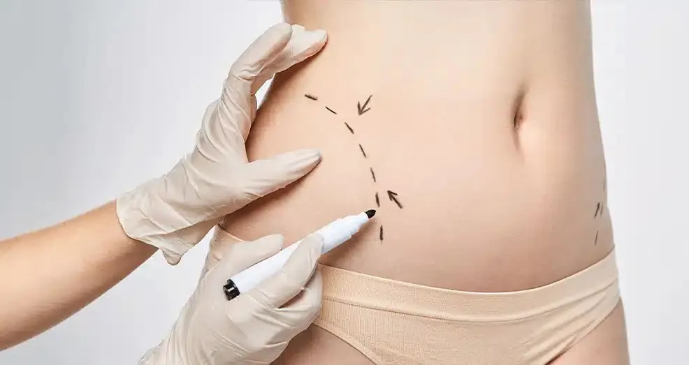 Body Contouring in Dubai: The Role of Personalized Treatment Planning