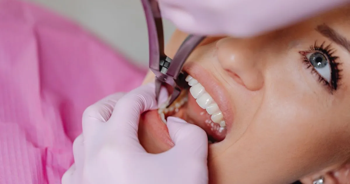 Dental Implants in Lahore: Procedure, Cost, Types, and Success Rate