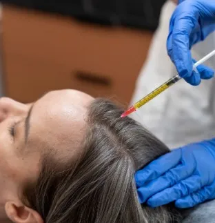 A Complete Beginner's Guide to Hair Transplant in Delhi