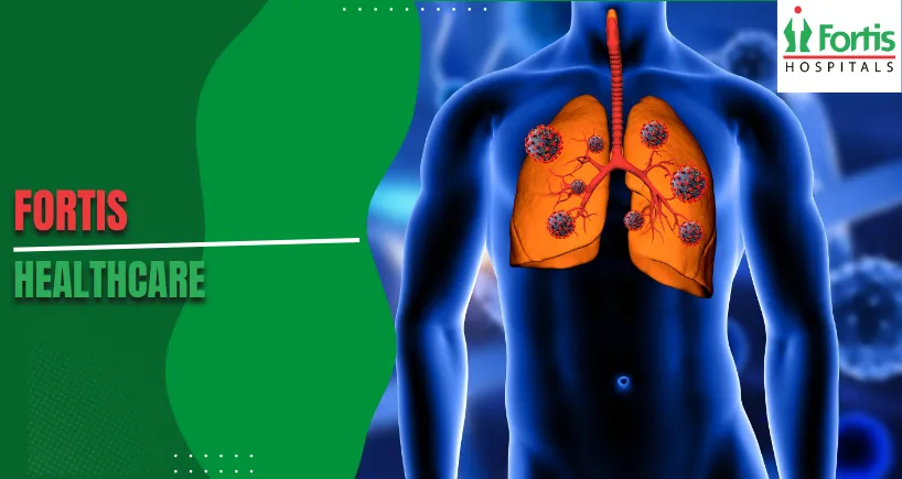 Treating Lung Tumors with Proton Therapy: A Safer Option for Patients with Weak Lungs